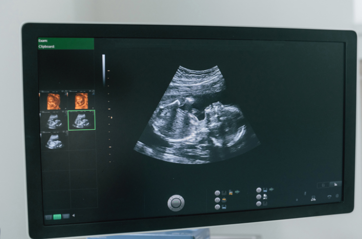 ultrasound scan